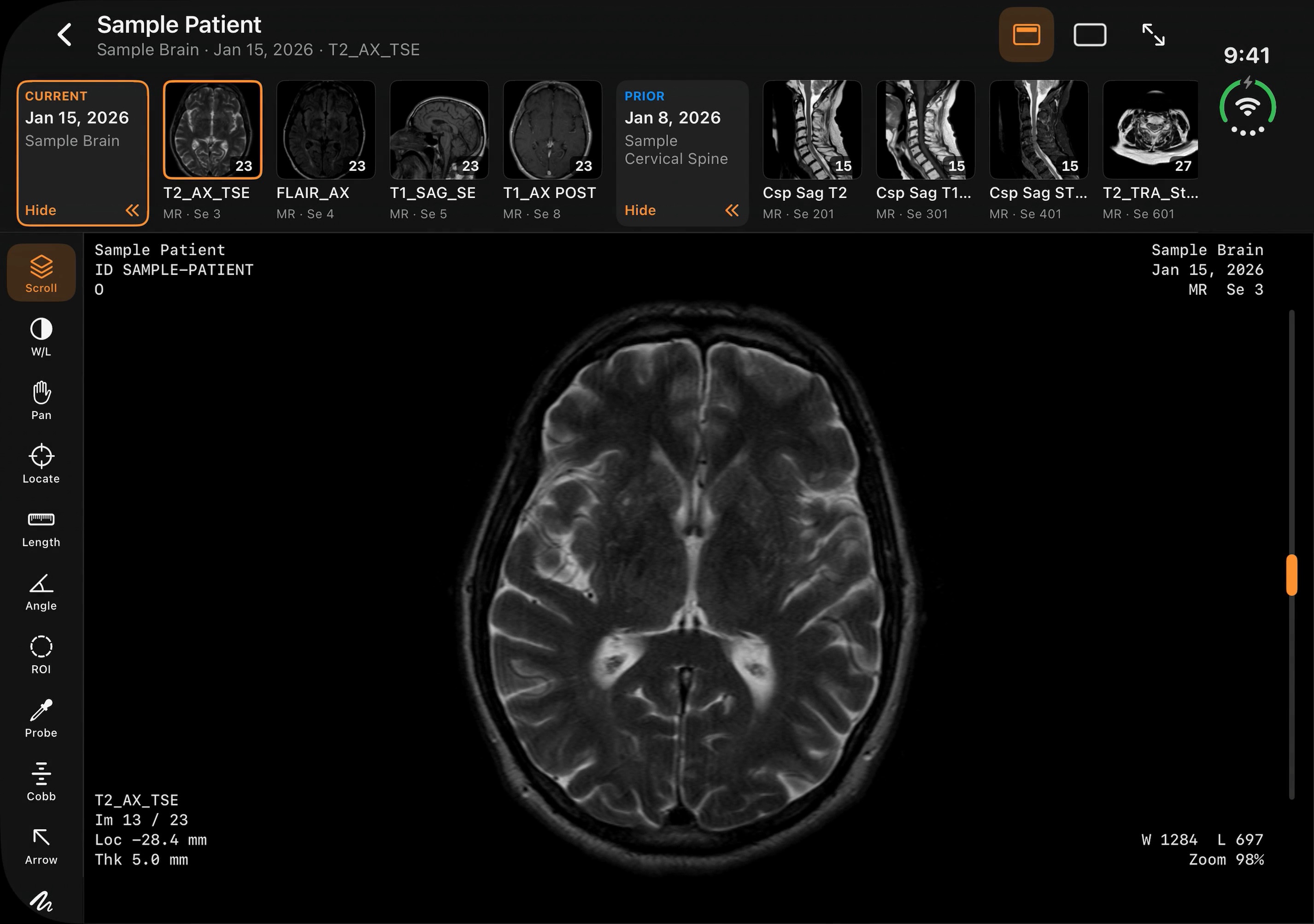 A sample brain MRI, T2 axial, beside its series