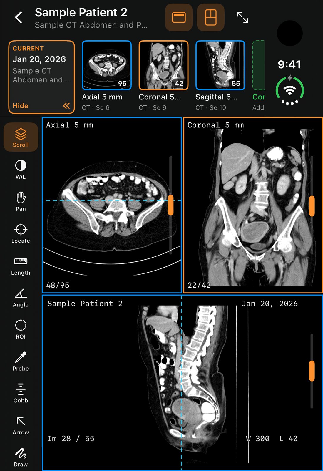 A sample CT in three planes, in portrait