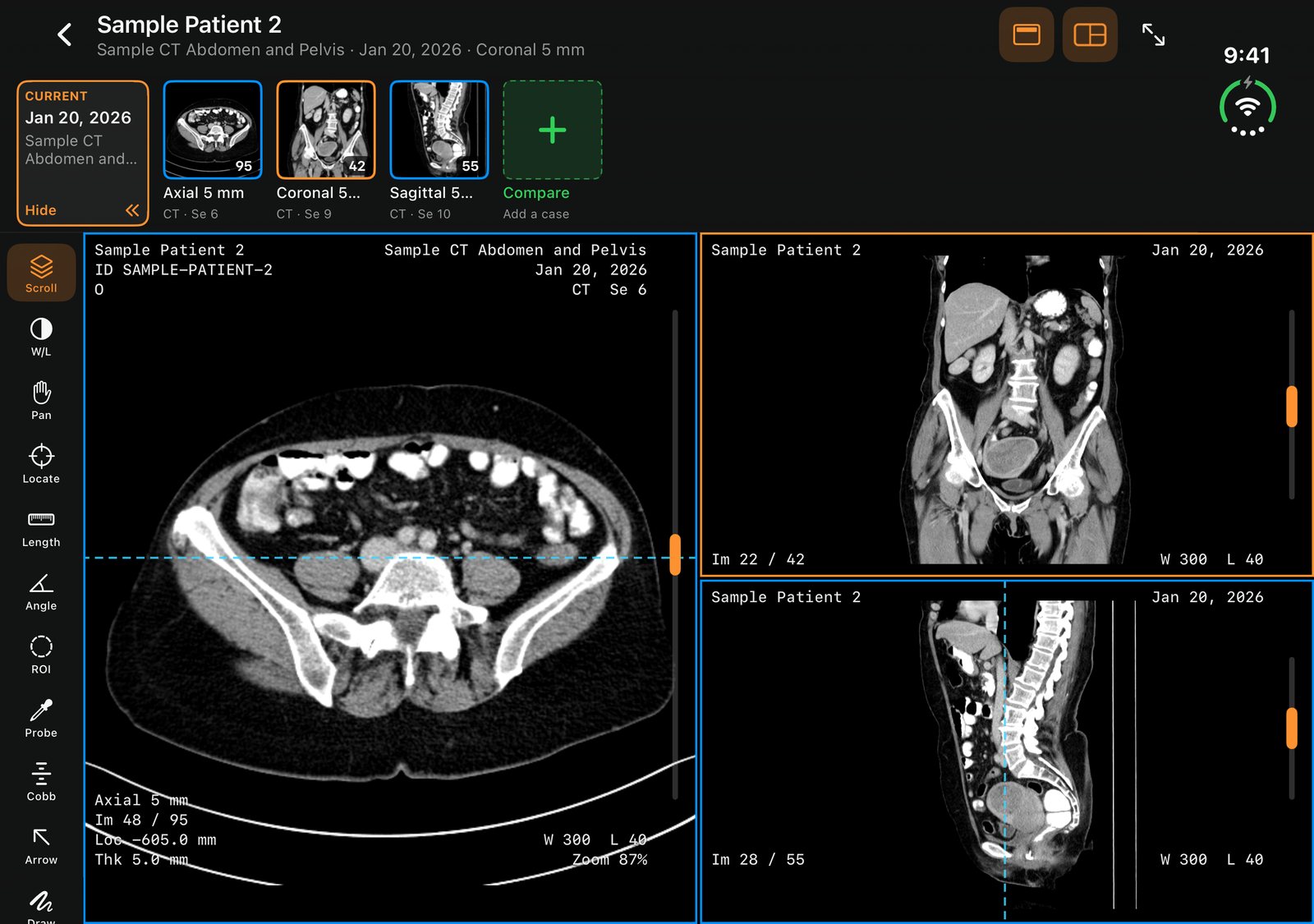 A sample CT, axial beside coronal and sagittal